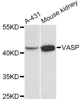 VASP Antibody - Western blot analysis of extracts of various cell lines, using VASP antibody at 1:3000 dilution. The secondary antibody used was an HRP Goat Anti-Rabbit IgG (H+L) at 1:10000 dilution. Lysates were loaded 25ug per lane and 3% nonfat dry milk in TBST was used for blocking. An ECL Kit was used for detection and the exposure time was 30s.