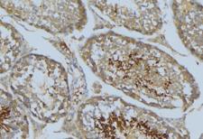 VASP Antibody - 1:100 staining mouse testis tissue by IHC-P. The sample was formaldehyde fixed and a heat mediated antigen retrieval step in citrate buffer was performed. The sample was then blocked and incubated with the antibody for 1.5 hours at 22°C. An HRP conjugated goat anti-rabbit antibody was used as the secondary.