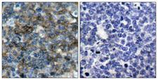 VASP Antibody - Immunohistochemistry analysis of paraffin-embedded human tonsil, using VASP (Phospho-Ser157) Antibody. The picture on the right is blocked with the phospho peptide.