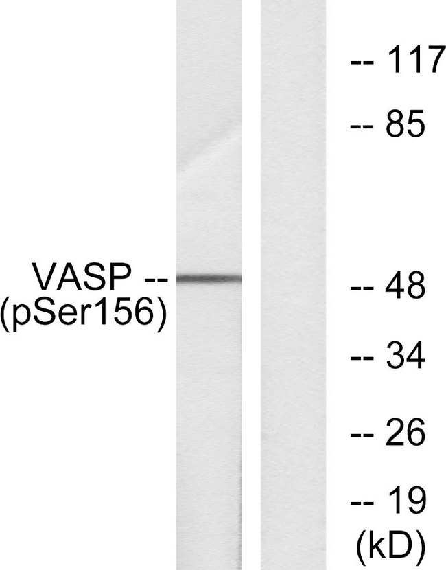VASP Antibody - Western blot analysis of lysates from NIH/3T3 cells treated with forskolin 40 muM 30', using VASP (Phospho-Ser157) Antibody. The lane on the right is blocked with the phospho peptide.