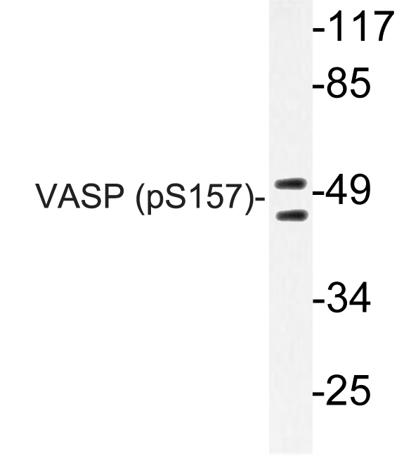 VASP Antibody - Western blot of p-VASP (S157) pAb in extracts from HeLa HUVEC cells.