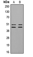 VASP Antibody - Western blot analysis of VASP (pS157) expression in C6 PMA-treated (A); HUVEC (B) whole cell lysates.