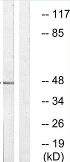 VASP Antibody - Western blot of extracts from HeLa, using VASP (Phospho-Ser157) Antibody.
