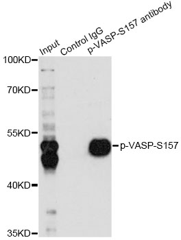 VASP Antibody - Immunoprecipitation analysis of 200ug extracts of A-431 cells, using 3 ug Phospho-VASP-S157 pAb. Western blot was performed from the immunoprecipitate using Phospho-VASP-S157 pAb at a dilition of 1:1000. A-431 cells were treated by Forskolin (10 uM) at 37°C for 30 minutes after serum-starvation overnight.