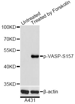 VASP Antibody - Western blot analysis of extracts of A431 cells, using Phospho-VASP-S157 antibody at 1:2000 dilution. A431 cells were treated by Forskolin (10uM) for 30 minutes after serum-starvation overnight. The secondary antibody used was an HRP Goat Anti-Rabbit IgG (H+L) at 1:10000 dilution. Lysates were loaded 25ug per lane and 3% nonfat dry milk in TBST was used for blocking. Blocking buffer: 3% BSA.An ECL Kit was used for detection and the exposure time was 1s.