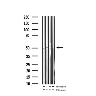 VASP Antibody - Western blot analysis of Phospho-VASP (Ser157) expression in various lysates