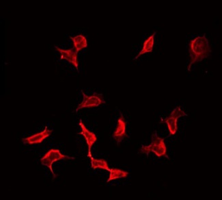 VASP Antibody - Staining HeLa cells by IF/ICC. The samples were fixed with PFA and permeabilized in 0.1% Triton X-100, then blocked in 10% serum for 45 min at 25°C. The primary antibody was diluted at 1:200 and incubated with the sample for 1 hour at 37°C. An Alexa Fluor 594 conjugated goat anti-rabbit IgG (H+L) Ab, diluted at 1/600, was used as the secondary antibody.