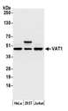 VAT1 Antibody - Detection of human VAT1 by western blot. Samples: Whole cell lysate (15 µg) from HeLa, HEK293T, and Jurkat cells prepared using NETN lysis buffer. Antibody: Affinity purified rabbit anti-VAT1 antibody used for WB at 0.1 µg/ml. Detection: Chemiluminescence with an exposure time of 10 seconds.
