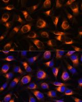 VAT1 Antibody - Immunofluorescence analysis of L929 cells using VAT1 Polyclonal Antibody at dilution of 1:100.Blue: DAPI for nuclear staining.