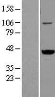 VAT1 Protein - Western validation with an anti-DDK antibody * L: Control HEK293 lysate R: Over-expression lysate