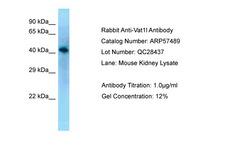 VAT1L Antibody -  This image was taken for the unconjugated form of this product. Other forms have not been tested.