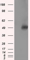 VAT1L Antibody - HEK293T cells were transfected with the pCMV6-ENTRY control (Left lane) or pCMV6-ENTRY VAT1L (Right lane) cDNA for 48 hrs and lysed. Equivalent amounts of cell lysates (5 ug per lane) were separated by SDS-PAGE and immunoblotted with anti-VAT1L.