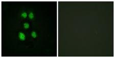 VAV1 / VAV Antibody - Immunofluorescence analysis of HeLa cells, using VAV1 Antibody. The picture on the right is blocked with the synthesized peptide.