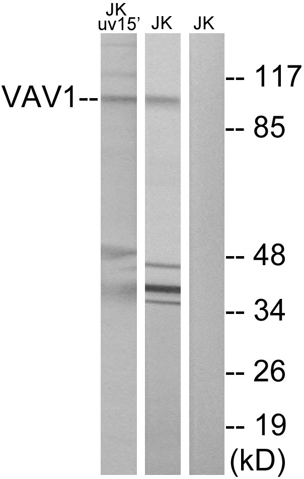 VAV1 / VAV Antibody - Western blot analysis of lysates from Jurkat cells, using VAV1 Antibody. The lane on the right is blocked with the synthesized peptide.