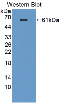 VAV1 / VAV Antibody - Western blot of VAV1 / VAV antibody.