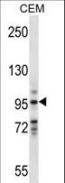VAV1 / VAV Antibody - VAV1 Antibody western blot of CEM cell line lysates (35 ug/lane). The VAV1 antibody detected the VAV1 protein (arrow).