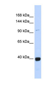VAV1 / VAV Antibody - VAV1 antibody Western blot of Fetal Heart lysate. This image was taken for the unconjugated form of this product. Other forms have not been tested.