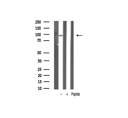 VAV1 / VAV Antibody - Western blot analysis of VAV1 expression in K562 whole cells lysates. The lane on the left is treated with the antigen-specific peptide.