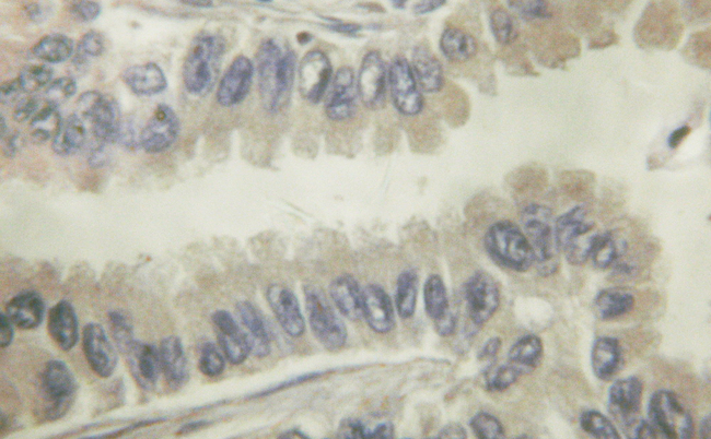 VAV1 / VAV Antibody - 1/100 staining human colon  tissue by IHC-P. The sample was formaldehyde fixed and a heat mediated antigen retrieval step in citrate buffer was performed. The sample was then blocked and incubated with the antibody for 1.5 hours at 22°C. An HRP conjugated goat anti-rabbit antibody was used as the secondary antibody.