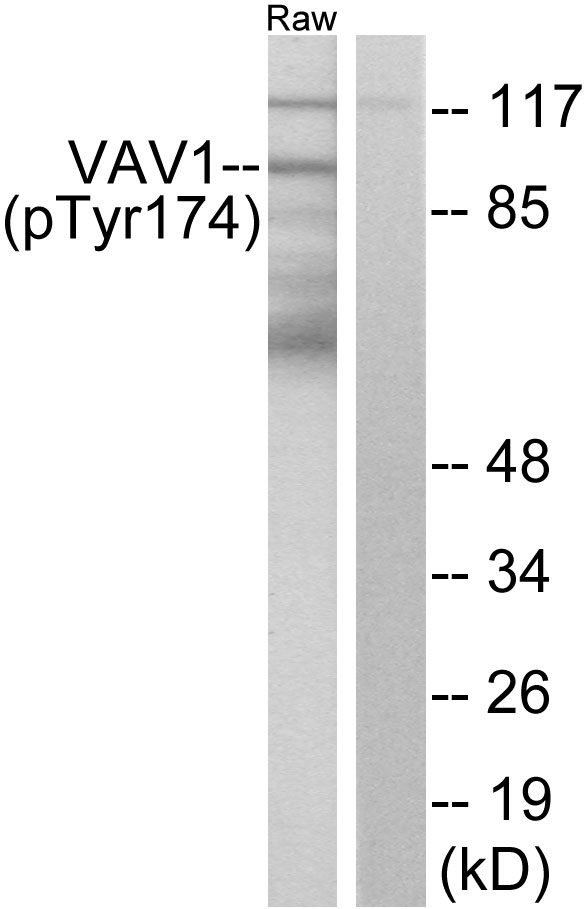 VAV1 / VAV Antibody - Western blot analysis of lysates from RAW264.7 cells, using VAV1 (Phospho-Tyr174) Antibody. The lane on the right is blocked with the phospho peptide.