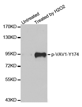 VAV1 / VAV Antibody - Western blot analysis of extracts from Jurkat cells.