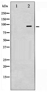 VAV1 / VAV Antibody - Western blot of VAV1 phosphorylation expression in K562 whole cell lysates,The lane on the left is treated with the antigen-specific peptide.