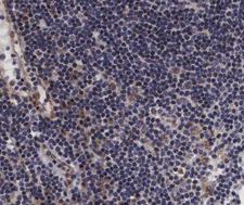 VAV1 / VAV Antibody - 1:200 staining human lymph node tissue by IHC-P. The tissue was formaldehyde fixed and a heat mediated antigen retrieval step in citrate buffer was performed. The tissue was then blocked and incubated with the antibody for 1.5 hours at 22°C. An HRP conjugated goat anti-rabbit antibody was used as the secondary.