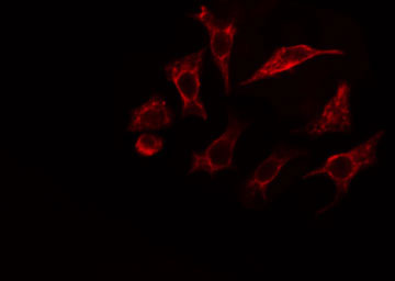 VAV1 / VAV Antibody - Staining HeLa cells by IF/ICC. The samples were fixed with PFA and permeabilized in 0.1% Triton X-100, then blocked in 10% serum for 45 min at 25°C. The primary antibody was diluted at 1:200 and incubated with the sample for 1 hour at 37°C. An Alexa Fluor 594 conjugated goat anti-rabbit IgG (H+L) antibody, diluted at 1/600, was used as secondary antibody.