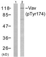 VAV1 / VAV Antibody - Western blot analysis of the extracts from Jurkat cells using Vav (phospho-Tyr174) antibody.