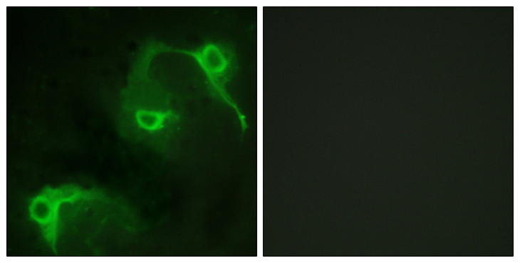 VAV2 Antibody - Immunofluorescence analysis of COS7 cells, using VAV2 Antibody. The picture on the right is blocked with the synthesized peptide.