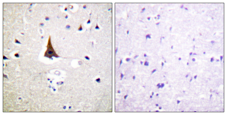 VAV2 Antibody - Immunohistochemistry analysis of paraffin-embedded human brain tissue, using VAV2 Antibody. The picture on the right is blocked with the synthesized peptide.