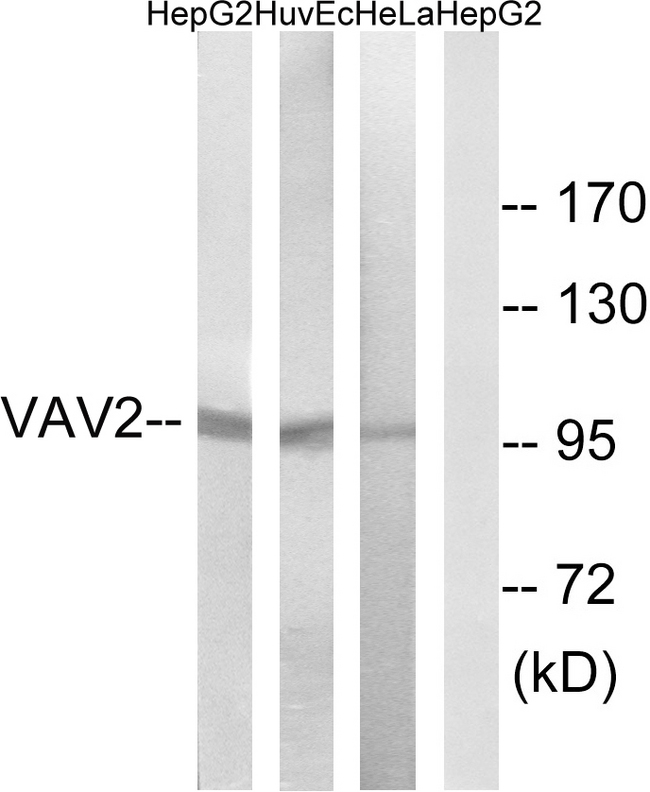 VAV2 Antibody - Western blot analysis of lysates from HepG2, HUVEC, and HeLa cells, using VAV2 Antibody. The lane on the right is blocked with the synthesized peptide.