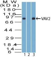 VAV2 Antibody - Western Blot: VAV2 Antibody - analysis of VAV2. Jurkat lysate in the 1) absence and 2) presence of immunizing peptide, and 3) K562 lysate probed with 3 ug/ml of VAV2 antibody. Goat anti-rabbit Ig HRP secondary antibody and PicoTect ECL substrate solution were used for this test.