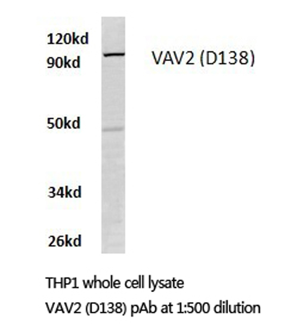 VAV2 Antibody - Western blot of VAV2 (D138) pAb in extracts from THP1 cells.