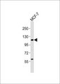 VAV2 Antibody - Anti-VAV2 Antibody at 1:1000 dilution + MCF-7 whole cell lysates Lysates/proteins at 20 ug per lane. Secondary Goat Anti-Rabbit IgG, (H+L),Peroxidase conjugated at 1/10000 dilution Predicted band size : 101 kDa Blocking/Dilution buffer: 5% NFDM/TBST.