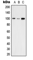 VAV2 Antibody - Western blot analysis of VAV2 expression in A431 (A); THP1 (B); NIH3T3 (C) whole cell lysates.
