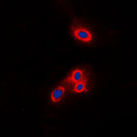VAV2 Antibody - Immunofluorescent analysis of VAV2 staining in THP1 cells. Formalin-fixed cells were permeabilized with 0.1% Triton X-100 in TBS for 5-10 minutes and blocked with 3% BSA-PBS for 30 minutes at room temperature. Cells were probed with the primary antibody in 3% BSA-PBS and incubated overnight at 4 C in a humidified chamber. Cells were washed with PBST and incubated with a DyLight 594-conjugated secondary antibody (red) in PBS at room temperature in the dark. DAPI was used to stain the cell nuclei (blue).