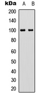 VAV2 Antibody - Western blot analysis of VAV2 (pY142) expression in A431 TNF-treated (A); HEK293T (B) whole cell lysates.