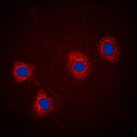 VAV2 Antibody - Immunofluorescent analysis of VAV2 (pY142) staining in A431 cells. Formalin-fixed cells were permeabilized with 0.1% Triton X-100 in TBS for 5-10 minutes and blocked with 3% BSA-PBS for 30 minutes at room temperature. Cells were probed with the primary antibody in 3% BSA-PBS and incubated overnight at 4 deg C in a humidified chamber. Cells were washed with PBST and incubated with a DyLight 594-conjugated secondary antibody (red) in PBS at room temperature in the dark. DAPI was used to stain the cell nuclei (blue).