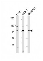 VAV2 Antibody - All lanes: Anti-VAV2 Antibody (N-Term) at 1:2000 dilution Lane 1: Hela whole cell lysate Lane 2: MCF-7 whole cell lysate Lane 3: SH-SY5Y whole cell lysate Lysates/proteins at 20 µg per lane. Secondary Goat Anti-Rabbit IgG, (H+L), Peroxidase conjugated at 1/10000 dilution. Predicted band size: 101 kDa Blocking/Dilution buffer: 5% NFDM/TBST.