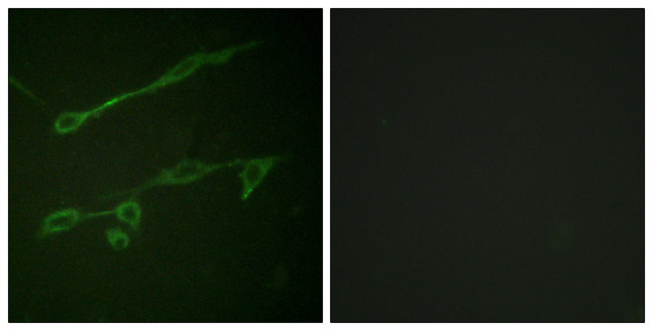 VAV2 Antibody - Immunofluorescence analysis of NIH/3T3 cells, using VAV2 (Phospho-Tyr142) Antibody. The picture on the right is blocked with the phospho peptide.