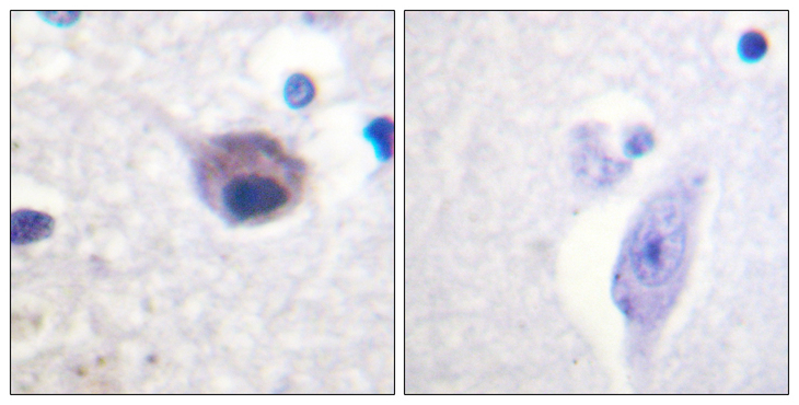 VAV2 Antibody - Immunohistochemistry analysis of paraffin-embedded human brain, using VAV2 (Phospho-Tyr142) Antibody. The picture on the right is blocked with the phospho peptide.