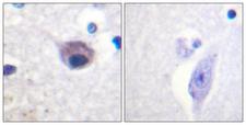 VAV2 Antibody - Immunohistochemistry analysis of paraffin-embedded human brain, using VAV2 (Phospho-Tyr142) Antibody. The picture on the right is blocked with the phospho peptide.