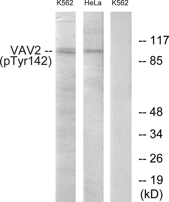 VAV2 Antibody - Western blot analysis of lysates from HeLa cells and K562 cells treated with TNF 20ng/ml 30', using VAV2 (Phospho-Tyr142) Antibody. The lane on the right is blocked with the phospho peptide.
