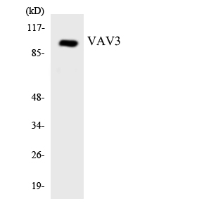VAV3 Antibody - Western blot analysis of the lysates from HepG2 cells using VAV3 antibody.