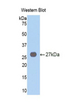 VAV3 Antibody - Western blot of recombinant VAV3.  This image was taken for the unconjugated form of this product. Other forms have not been tested.