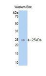 VAV3 Antibody - Western blot of recombinant VAV3.  This image was taken for the unconjugated form of this product. Other forms have not been tested.