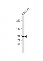 VAV3 Antibody - Anti-VAV3 Antibody at 1:2000 dilution + human kidney lysate Lysates/proteins at 20 ug per lane. Secondary Goat Anti-Rabbit IgG, (H+L), Peroxidase conjugated at 1:10000 dilution. Predicted band size: 98 kDa. Blocking/Dilution buffer: 5% NFDM/TBST.