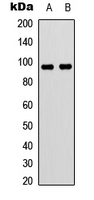 VAV3 Antibody - Western blot analysis of VAV3 expression in HEK293T (A); Jurkat (B) whole cell lysates.