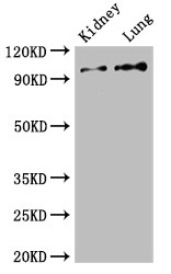 VAV3 Antibody - Positive WB detected in:Mouse kidney tissue,Rat lung tissue;All lanes:VAV3 antibody at 2.5?g/ml;Secondary;Goat polyclonal to rabbit IgG at 1/50000 dilution;Predicted band size: 98,87,33,101 KDa;Observed band size: 98 KDa;